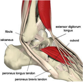 inestabilidad de los tendones peroneos