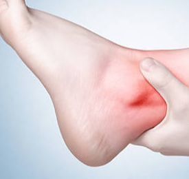 Diagnóstico y tratamiento del pinzamiento de tobillo o síndrome de impactación anterior de tobillo.